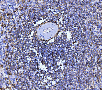 CD20 Mouse Monoclonal Antibody