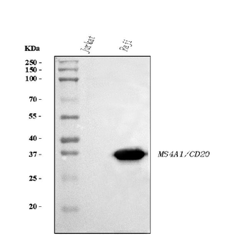 CD20 Mouse Monoclonal Antibody