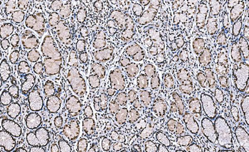 Histone H1.0/H1F0 Antibody (monoclonal, 5I3E6)