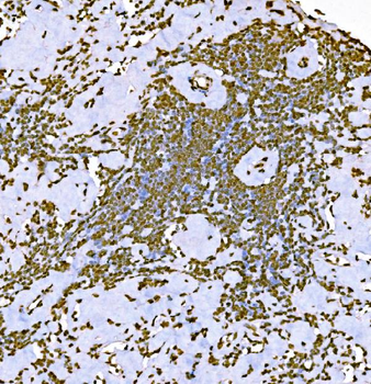 Histone H1.0/H1F0 Antibody (monoclonal, 5I3E6)