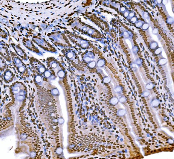 Histone H1.0/H1F0 Antibody (monoclonal, 5I3E6)