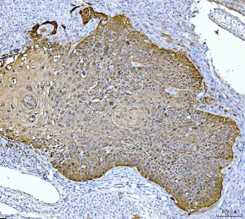 MASPIN Mouse Monoclonal Antibody