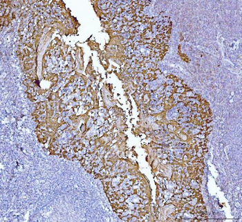 MASPIN Mouse Monoclonal Antibody