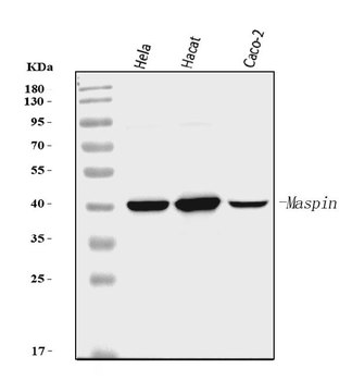 MASPIN Mouse Monoclonal Antibody