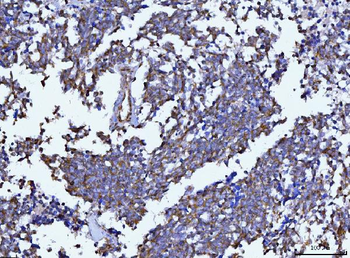Beclin 1 Antibody (monoclonal, 2D12A3)