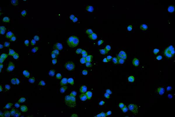 TRPV1 Antibody