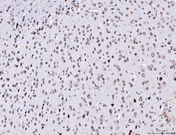 TPR Rabbit Polyclonal Antibody
