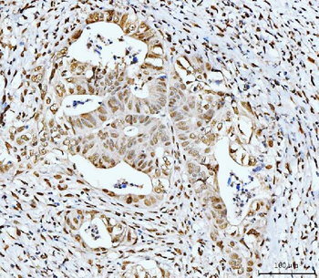 53BP1/TP53BP1 Antibody