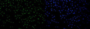 53BP1/TP53BP1 Antibody