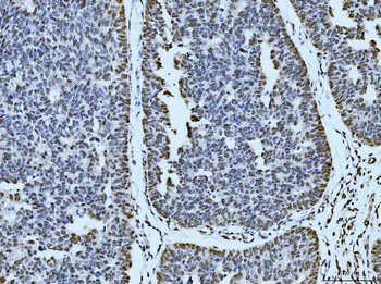 53BP1/TP53BP1 Antibody