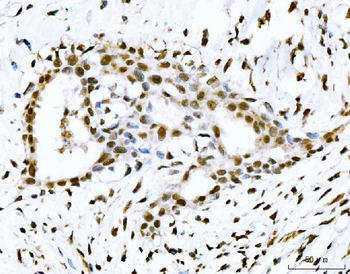 53BP1/TP53BP1 Antibody