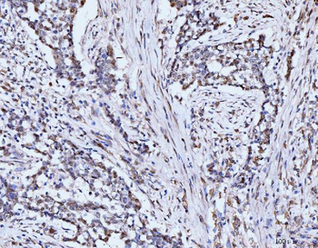 53BP1/TP53BP1 Antibody