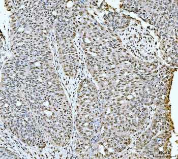 53BP1/TP53BP1 Antibody