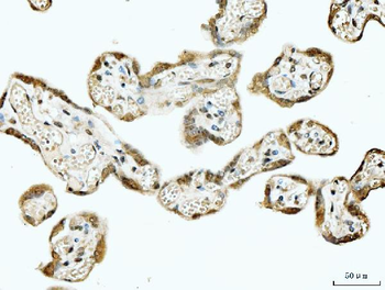 53BP1/TP53BP1 Antibody