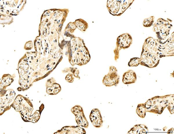 53BP1/TP53BP1 Antibody