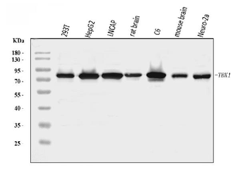 NAK/TBK1 Rabbit Polyclonal Antibody