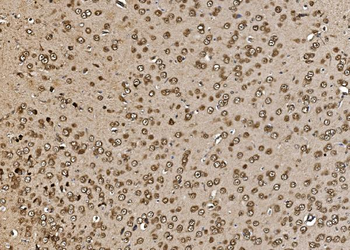 Proteasome 20S beta 7/PSMB7 Antibody