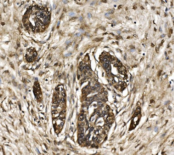 Proteasome 20S beta 7/PSMB7 Antibody