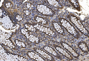 Proteasome 20S beta 7/PSMB7 Antibody