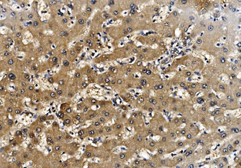 Proteasome 20S beta 7/PSMB7 Antibody