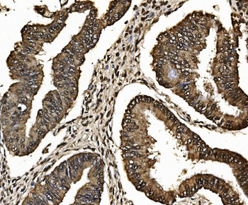Proteasome 20S beta 7/PSMB7 Antibody