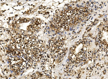 Proteasome 20S beta 7/PSMB7 Antibody