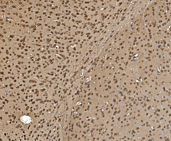 Proteasome 20S beta 7/PSMB7 Antibody
