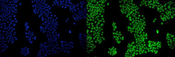 PPAR gamma/PPARG Rabbit Polyclonal Antibody