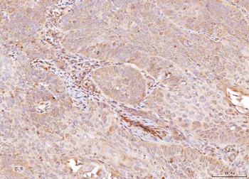 NDUFB8 Antibody