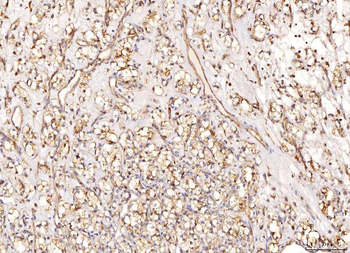 NDUFB8 Antibody