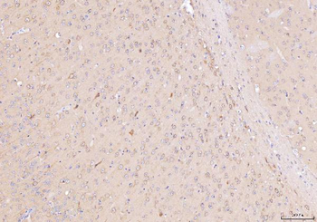 NDUFB8 Antibody