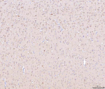 NDUFB8 Antibody