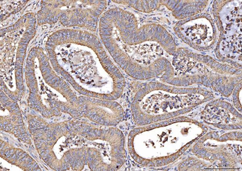 MT-CO2/MT Rabbit Polyclonal Antibody