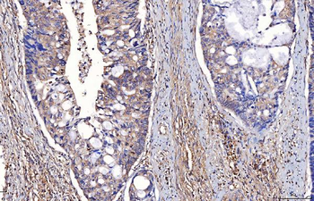 ENO1 Antibody