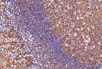 ENO1 Antibody