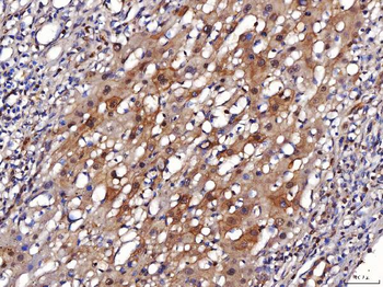 ENO1 Antibody