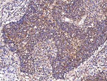 ENO1 Antibody
