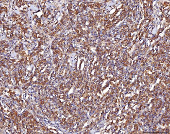 ENO1 Antibody