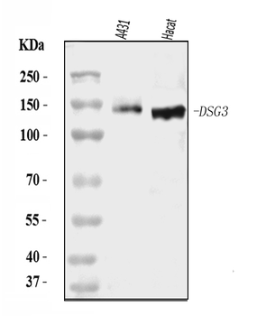 Desmoglein 3/PVA/DSG3 Rabbit Polyclonal Antibody