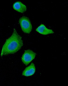 DAB2 Rabbit Polyclonal Antibody