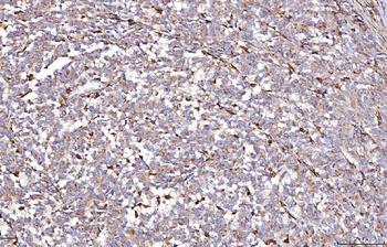 DAB2 Rabbit Polyclonal Antibody