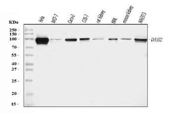 DAB2 Rabbit Polyclonal Antibody