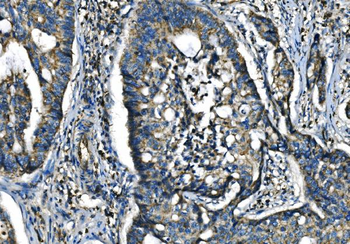CX3CR1 Antibody