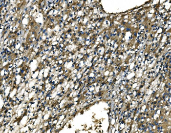 CX3CR1 Antibody