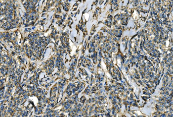 CX3CR1 Antibody