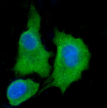 ALDH3A1 Rabbit Polyclonal Antibody