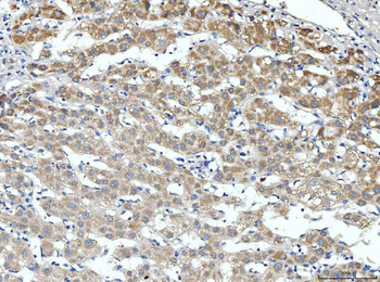 ALDH3A1 Rabbit Polyclonal Antibody