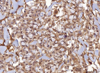 AHA1/AHSA1 Antibody