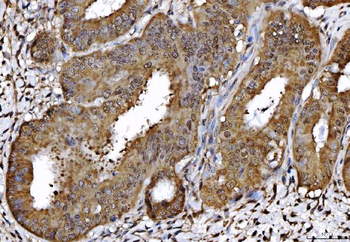 AHA1/AHSA1 Antibody