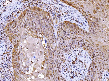 AHA1/AHSA1 Antibody